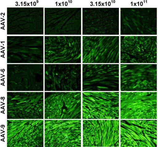 AAV感染心脏
