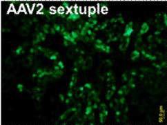 AAV2感染肾脏